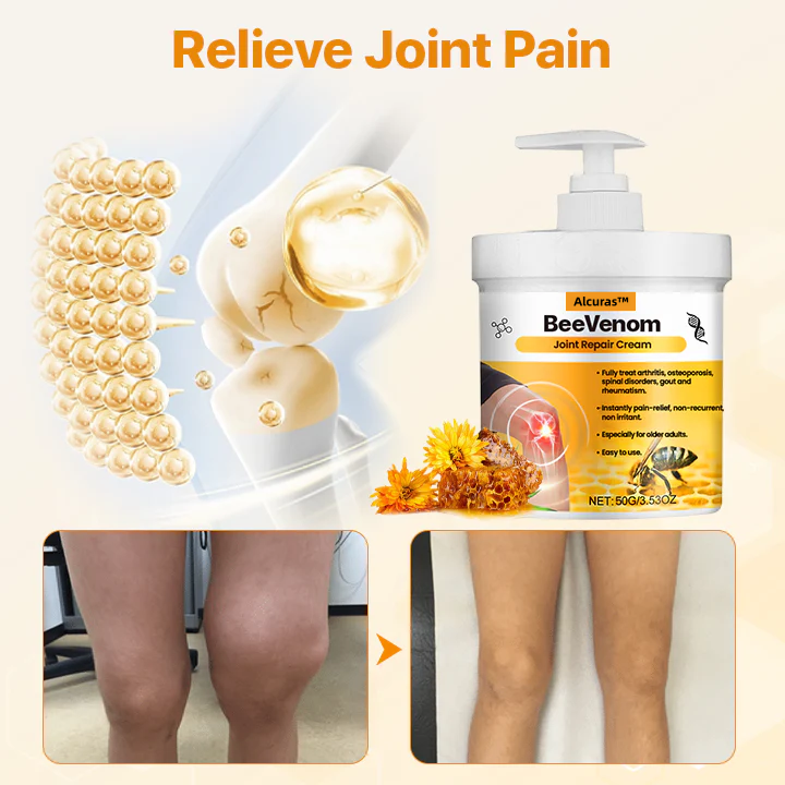 Alcuras™ BeeVenom Joint Repair Cream