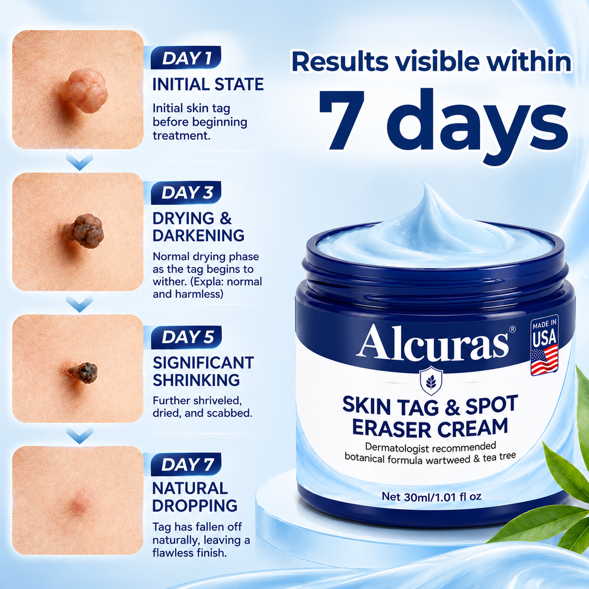 Alcuras® 7-Day Skin Tag & Spot Eraser Cream