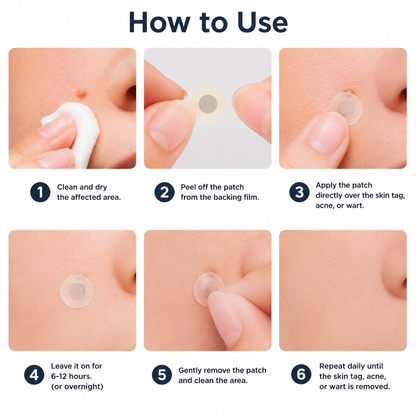 ✨Alcuras®2-in-1 Microneedle & Hydrocolloid Patch🍀| Removes Raised Moles, Acne, Flat Warts & Skin Tags | Helps Improve Wrinkles, Scars & Blemishes | Invisible Patches for Face & Body