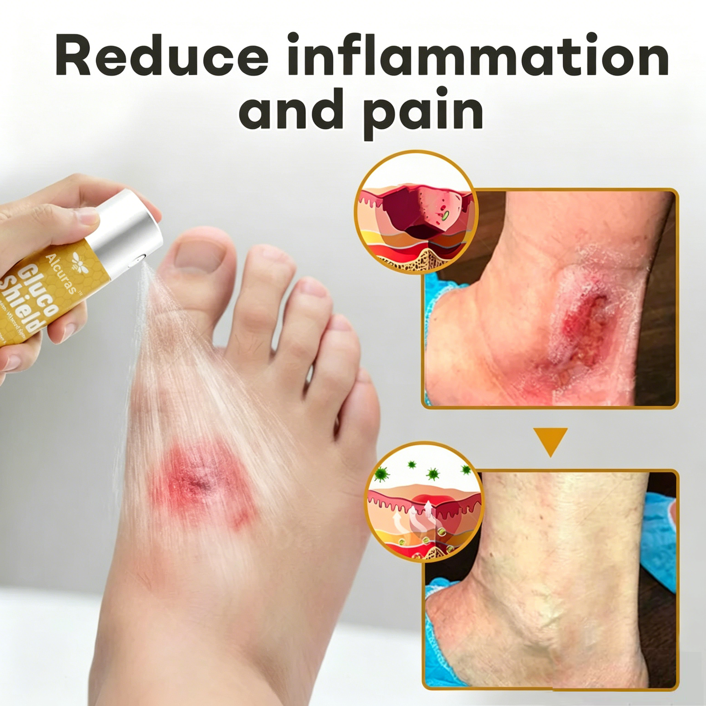 Alcuras™ GlucoShield Bee Venom Wound Spray💪