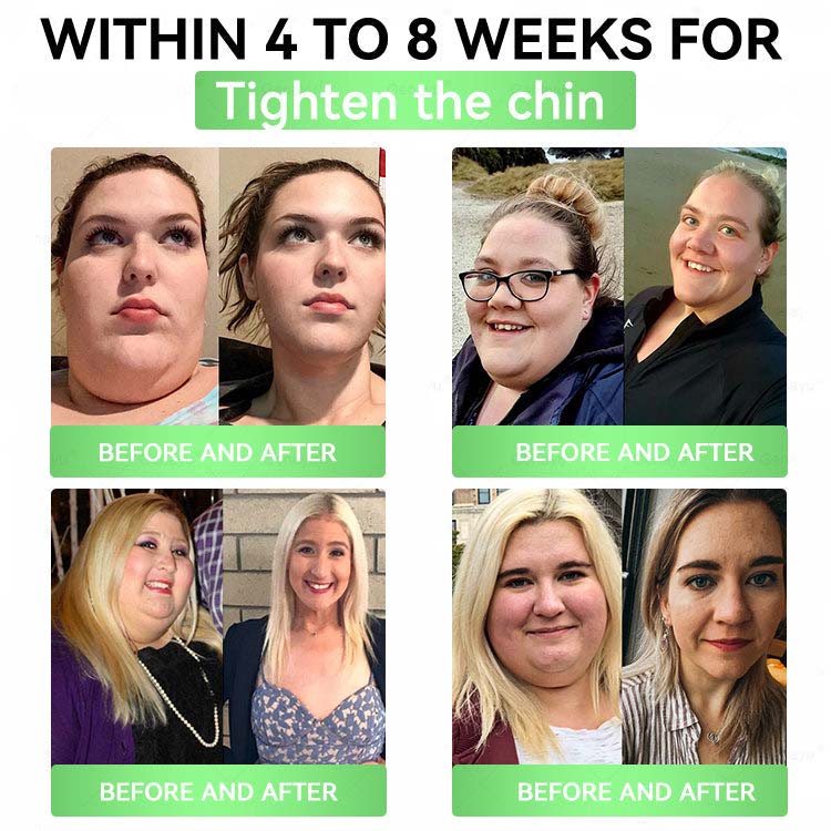 🎁🎁Alcuras® Moringa 8-Benefit Slimming & Metabolic Nano Microneedle changes in 7 days)  For obesity, Loose Skin,diabetes, sleep apnea, joint issues, and more