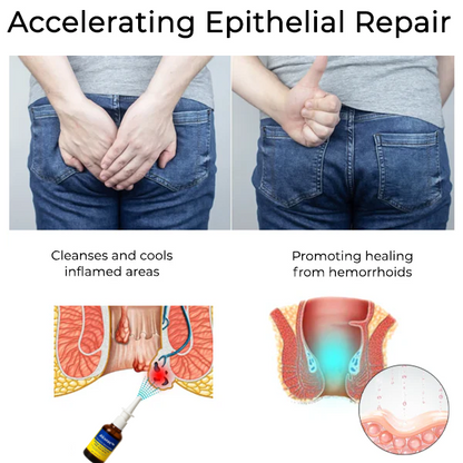 Alcuras™ Herbal Hemorrhoid Treatment Anal Spray Pro