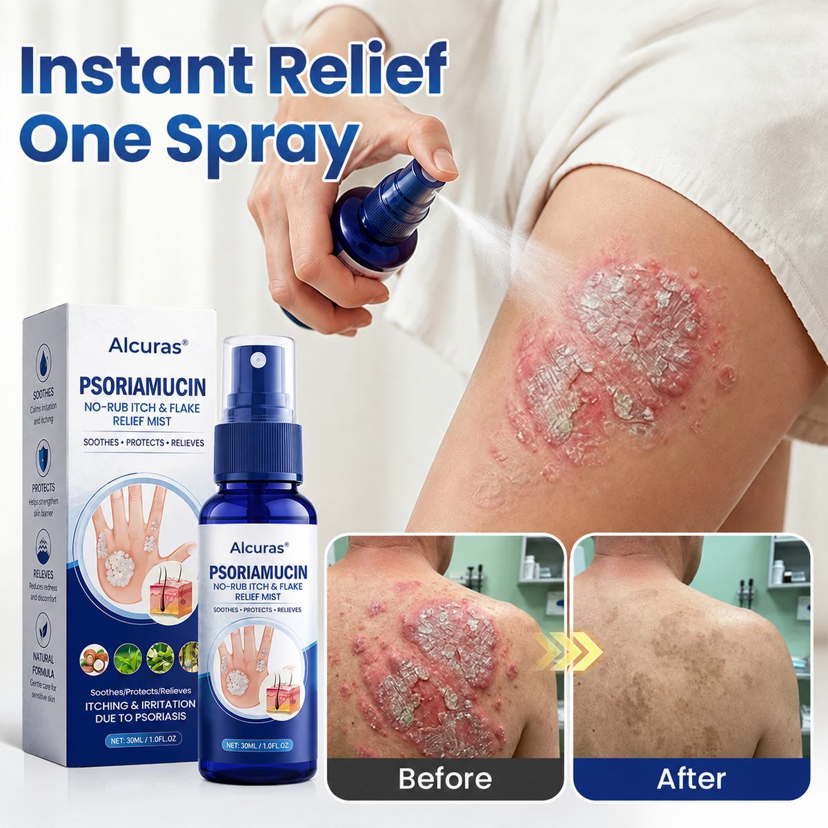 Alcuras® PsoriaMucin No-Rub Itch & Flake Relief Mist