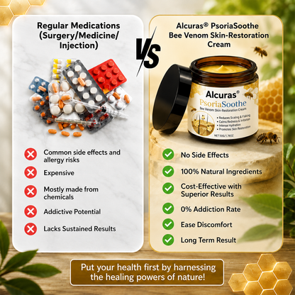 Alcuras® PsoriaSoothe Bee Venom Skin-Restoration Cream