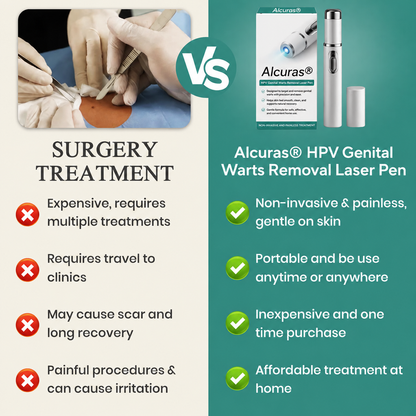 Alcuras® HPV Genital Warts Removal Laser Pen