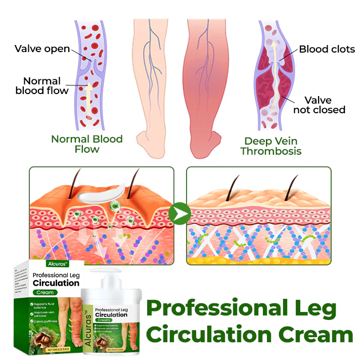Alcuras™ Professional Leg Circulation Cream