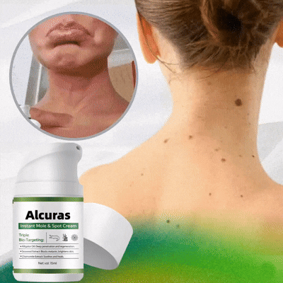 Alcuras™ Nature Erase: Erase Unwanted Marks in 7 Days Without Surgery, Pain