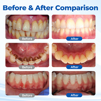 Alcuras® GumBiome Recovery Gel
