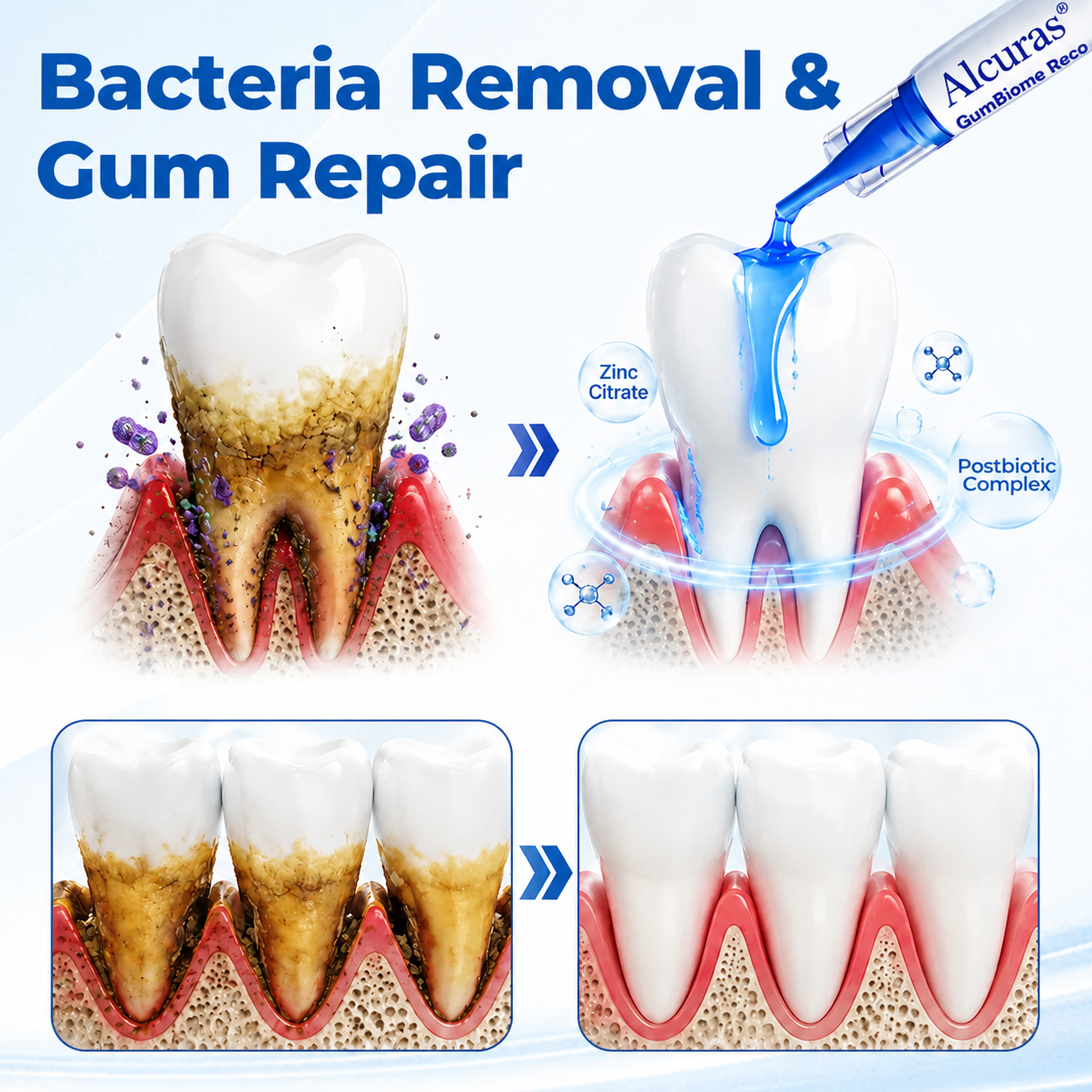 Alcuras® GumBiome Recovery Gel