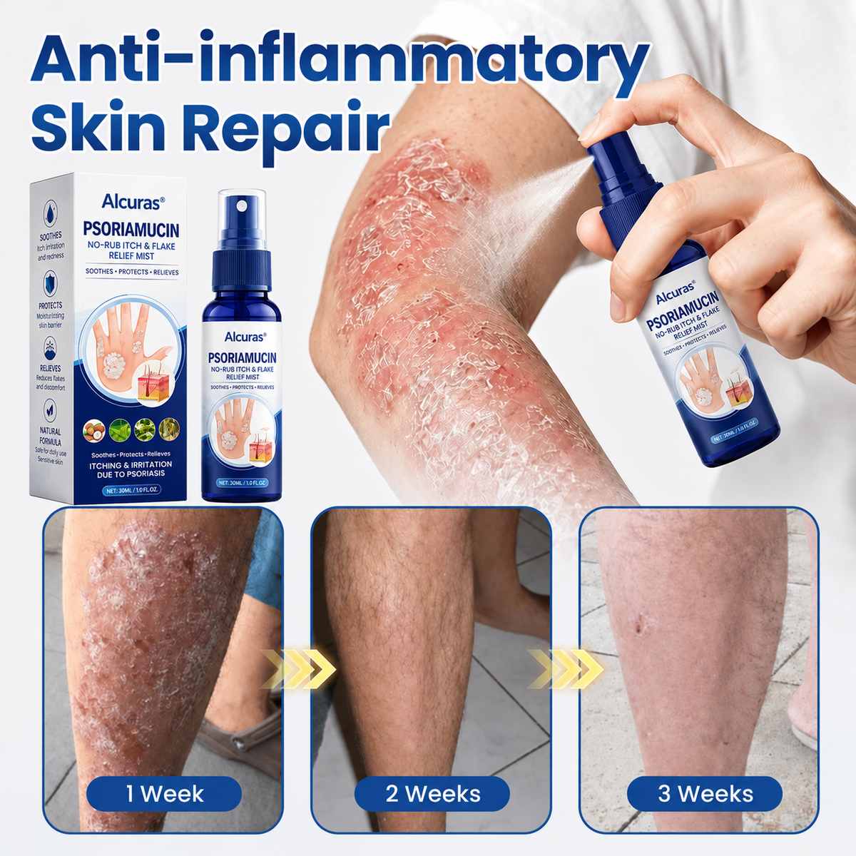 Alcuras® PsoriaMucin No-Rub Itch & Flake Relief Mist