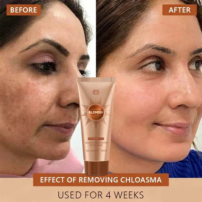 Alcuras™ Whitening and Spot-Removing Face Mask Suitable for face and body – 👩‍⚕️ Natural ingredients permanently remove age spots, freckles, sun spots, and liver spots.