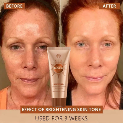 Alcuras™ Whitening and Spot-Removing Face Mask Suitable for face and body – 👩‍⚕️ Natural ingredients permanently remove age spots, freckles, sun spots, and liver spots.