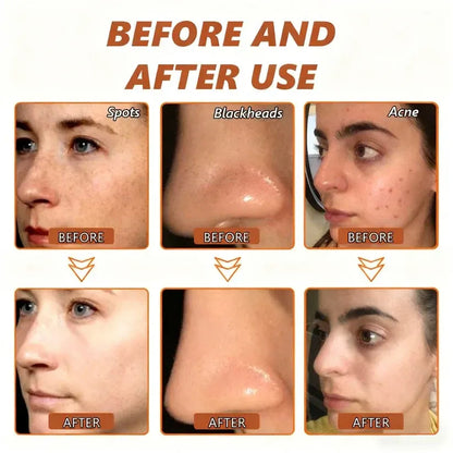 Alcuras™ Whitening and Spot-Removing Face Mask Suitable for face and body – 👩‍⚕️ Natural ingredients permanently remove age spots, freckles, sun spots, and liver spots.