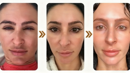Alcuras™ Whitening and Spot-Removing Face Mask Suitable for face and body – 👩‍⚕️ Natural ingredients permanently remove age spots, freckles, sun spots, and liver spots.
