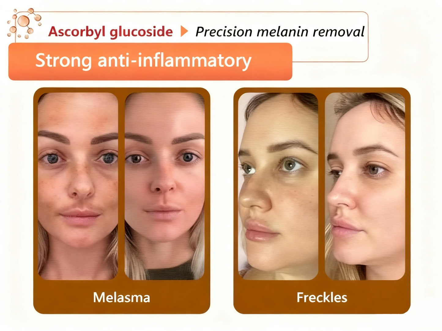 Alcuras™ Whitening and Spot-Removing Face Mask Suitable for face and body – 👩‍⚕️ Natural ingredients permanently remove age spots, freckles, sun spots, and liver spots.