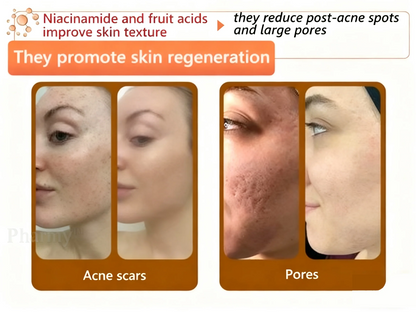 Alcuras™ Whitening and Spot-Removing Face Mask Suitable for face and body – 👩‍⚕️ Natural ingredients permanently remove age spots, freckles, sun spots, and liver spots.