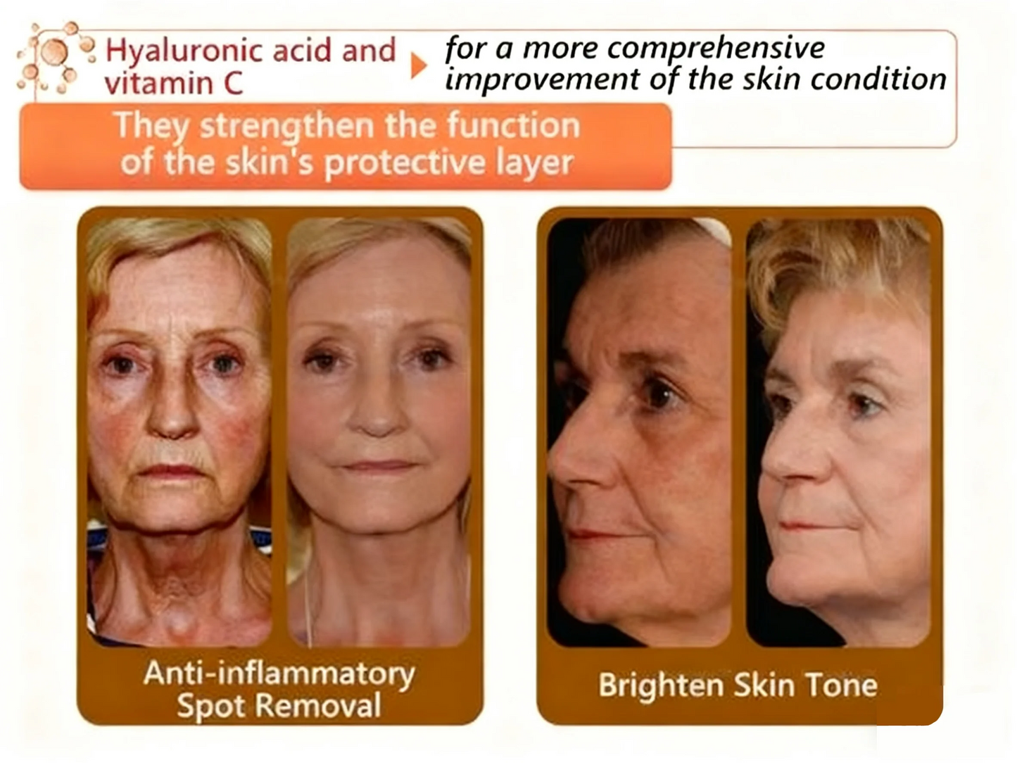 Alcuras™ Whitening and Spot-Removing Face Mask Suitable for face and body – 👩‍⚕️ Natural ingredients permanently remove age spots, freckles, sun spots, and liver spots.
