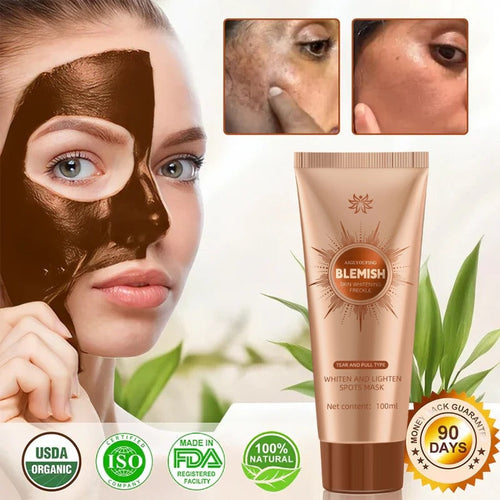 Alcuras™ Whitening and Spot-Removing Face Mask Suitable for face and body – 👩‍⚕️ Natural ingredients permanently remove age spots, freckles, sun spots, and liver spots.