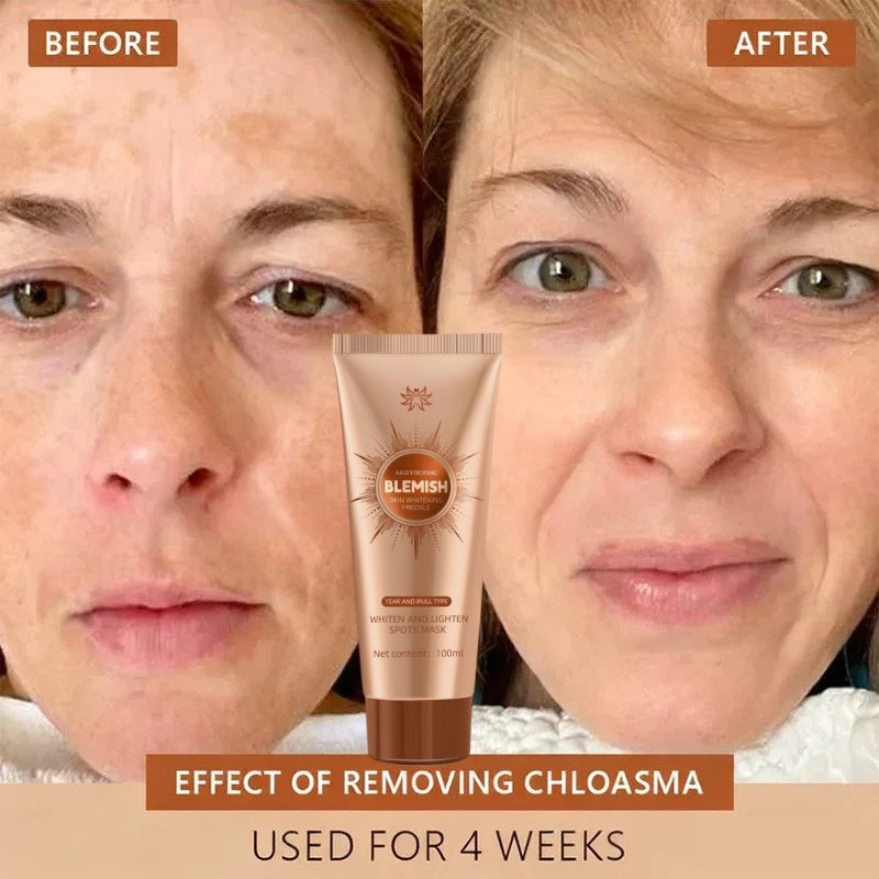 Alcuras™ Whitening and Spot-Removing Face Mask Suitable for face and body – 👩‍⚕️ Natural ingredients permanently remove age spots, freckles, sun spots, and liver spots.