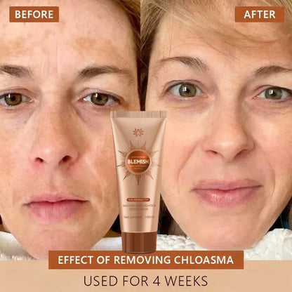 Alcuras™ Whitening and Spot-Removing Face Mask Suitable for face and body – 👩‍⚕️ Natural ingredients permanently remove age spots, freckles, sun spots, and liver spots.