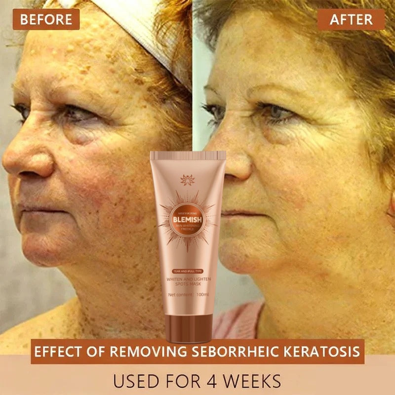 Alcuras™ Whitening and Spot-Removing Face Mask Suitable for face and body – 👩‍⚕️ Natural ingredients permanently remove age spots, freckles, sun spots, and liver spots.