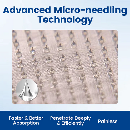 Alcuras™ Vein Ease Microneedle Therapy Patch - Fast ⚡Effective 💪 and Non-Invasive 🚫 Treatment for Varicose Veins & Leg Swelling 👣