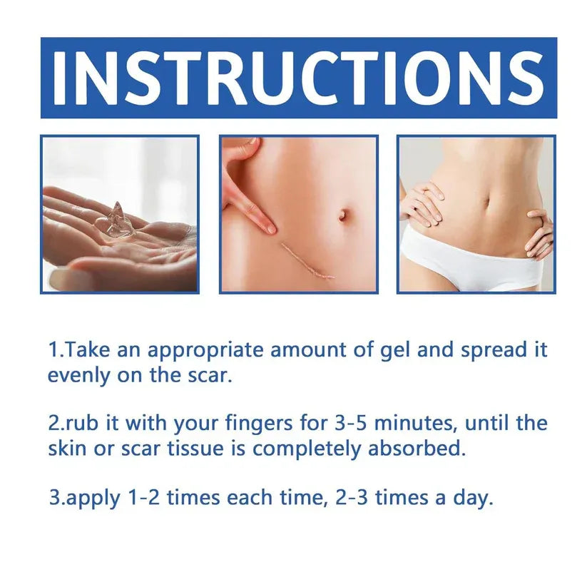 Alcuras Medical Grade Silicone Scar Cream – Smooth Scars Fast!