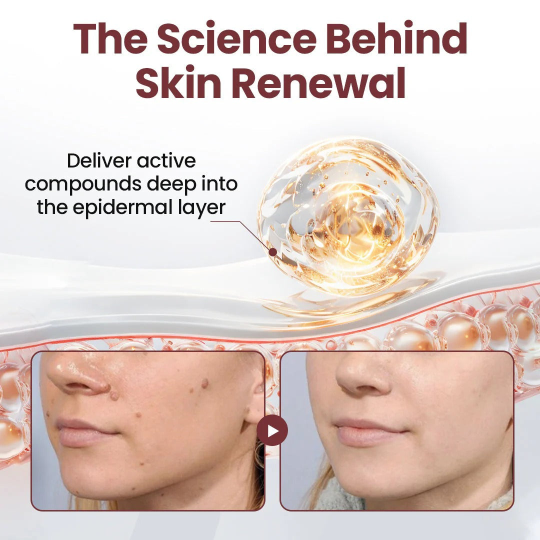 Alcuras™ KeraErase Dual-Action Renewal Cream