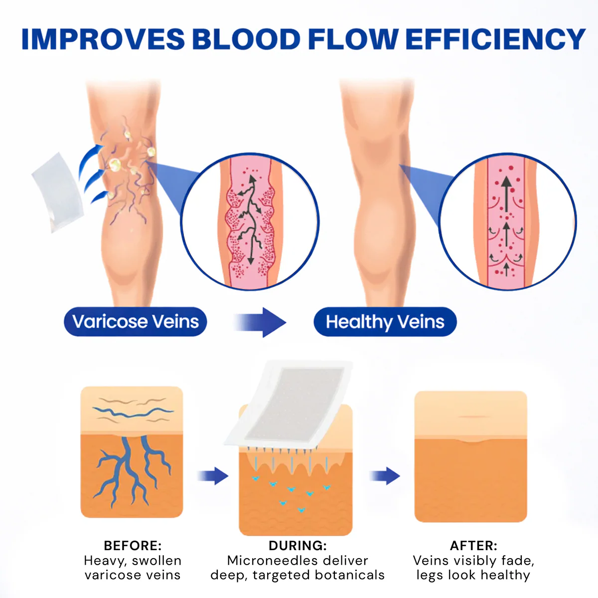 Alcuras® Vein Contour Microneedle Patch – 7-Day Visible Results for Varicose Veins