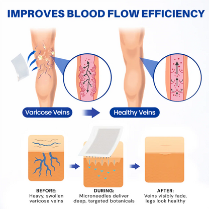 Alcuras® Vein Contour Microneedle Patch – 7-Day Visible Results for Varicose Veins