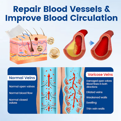 Alcuras™ Vein Ease Microneedle Therapy Patch - Fast ⚡Effective 💪 and Non-Invasive 🚫 Treatment for Varicose Veins & Leg Swelling 👣