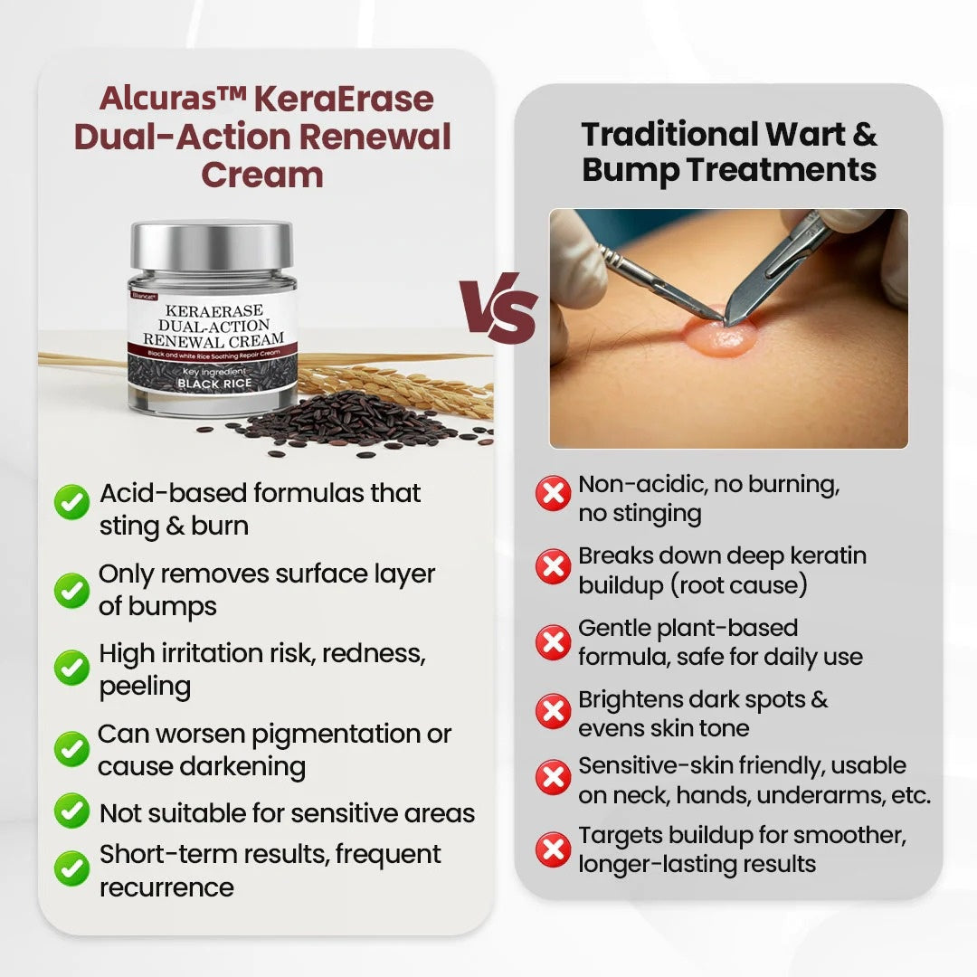 Alcuras™ KeraErase Dual-Action Renewal Cream