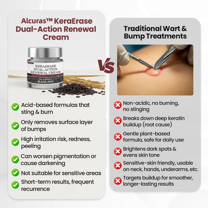 Alcuras™ KeraErase Dual-Action Renewal Cream