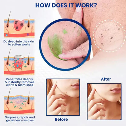 Alcuras™ Nature Erase: Erase Unwanted Marks in 7 Days Without Surgery, Pain