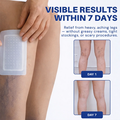 Alcuras® Vein Contour Microneedle Patch – 7-Day Visible Results for Varicose Veins
