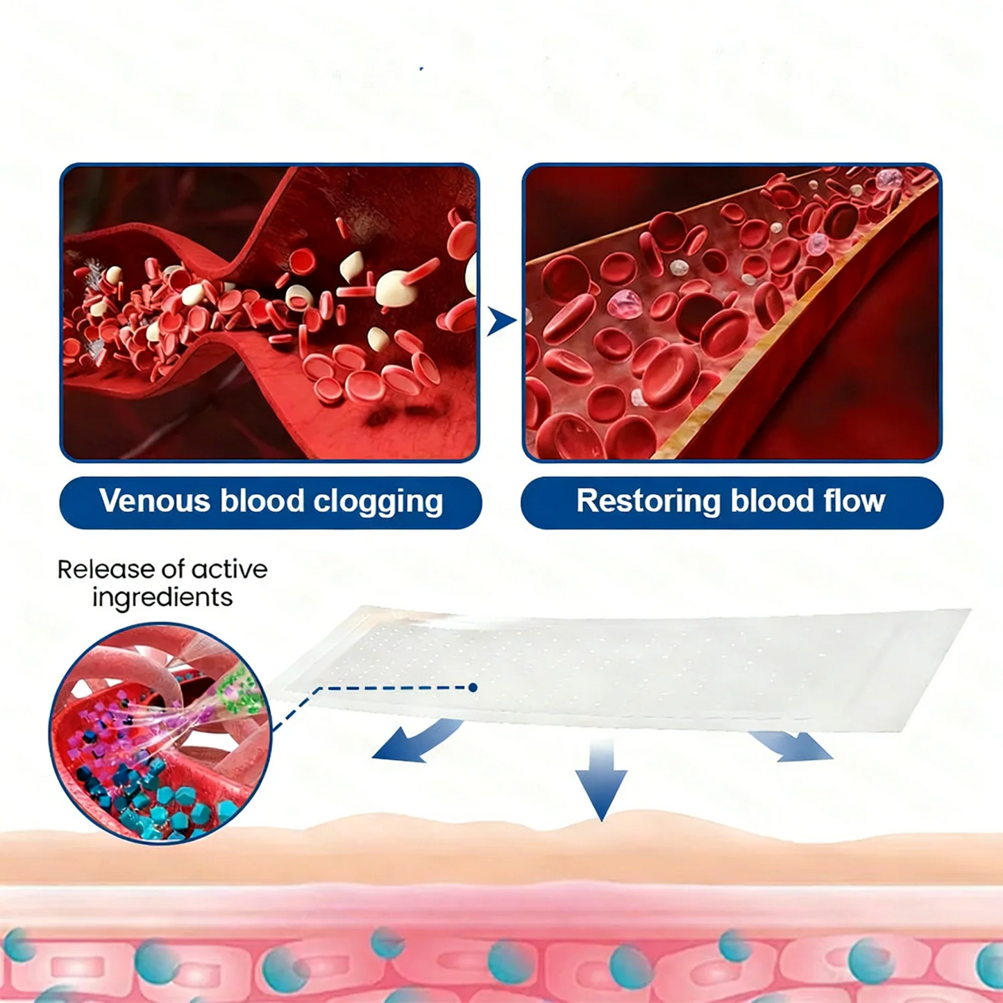 Alcuras® Vein Contour Microneedle Patch – 7-Day Visible Results for Varicose Veins