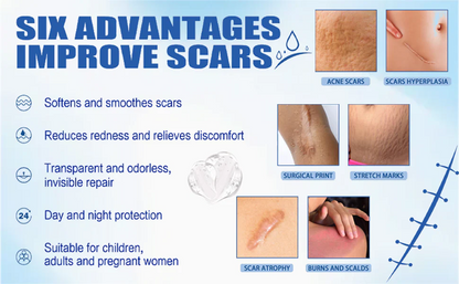 Alcuras Medical Grade Silicone Scar Cream – Smooth Scars Fast!
