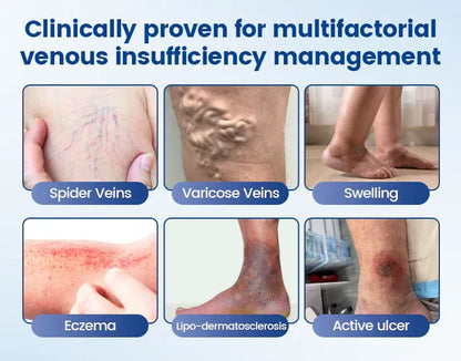 Alcuras™ Vein Ease Microneedle Therapy Patch - Fast ⚡Effective 💪 and Non-Invasive 🚫 Treatment for Varicose Veins & Leg Swelling 👣