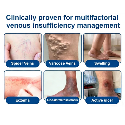 Alcuras® Vein Contour Microneedle Patch – 7-Day Visible Results for Varicose Veins