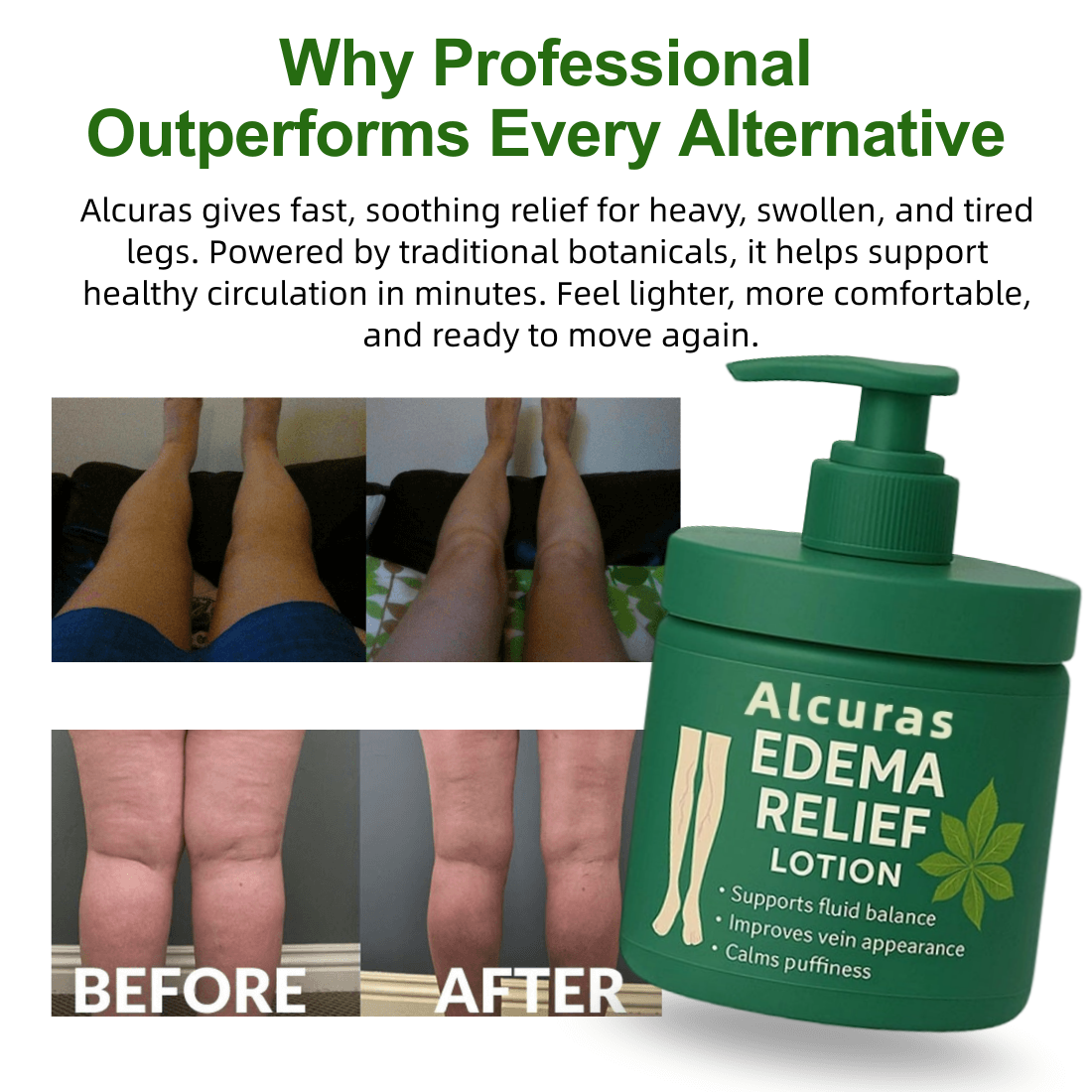 Alcuras™ Edema Relief Lotion