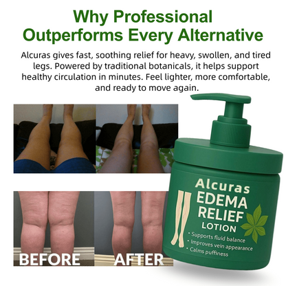 Alcuras™ Edema Relief Lotion