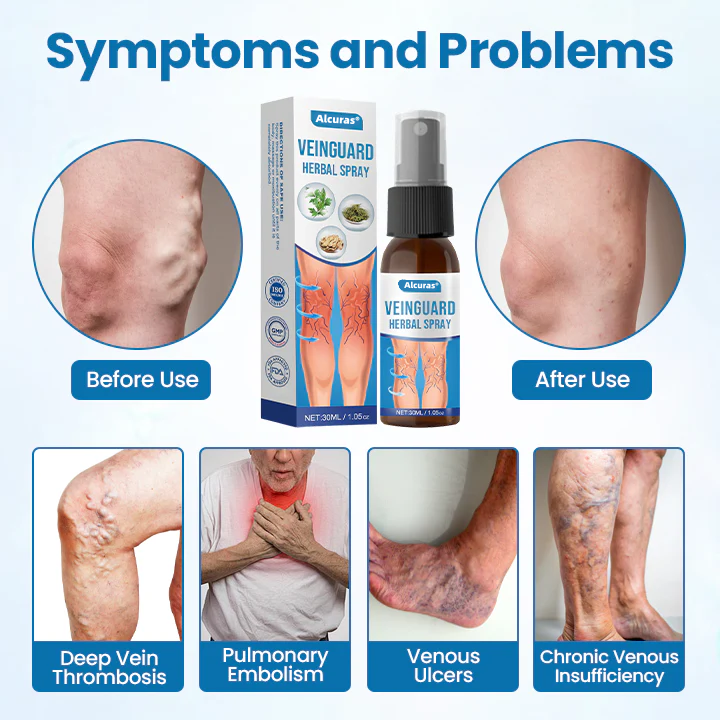 Alcuras® VeinGuard Herbal Spray