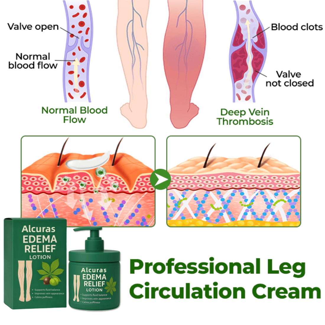 Alcuras™ Edema Relief Lotion
