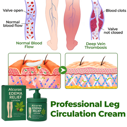Alcuras™ Edema Relief Lotion