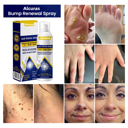 Alcuras® Skin repair agents