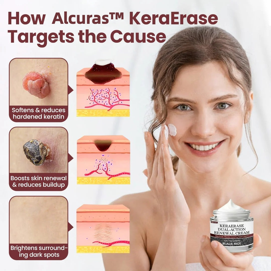 Alcuras™ KeraErase Dual-Action Renewal Cream