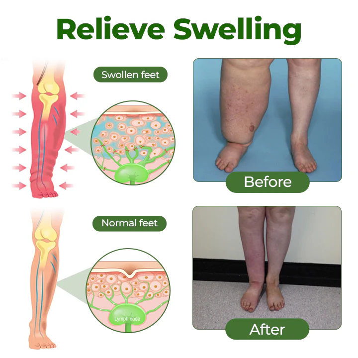 Alcuras™ Professional Leg Circulation Cream