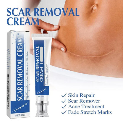 Alcuras Medical Grade Silicone Scar Cream – Smooth Scars Fast!
